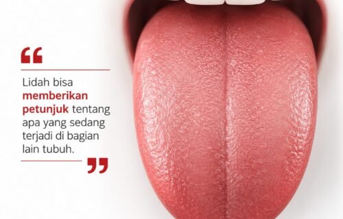 Lidah Anda Bisa Membocorkan Kondisi Tubuh, Ini Tanda-Tanda yang Tak Boleh Diabaikan